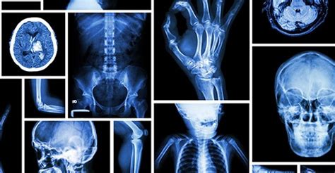 the villages x ray imaging